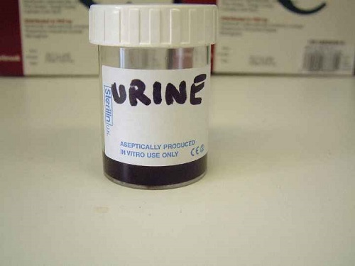 1 Copper poisoning sheep black urine